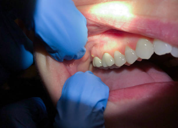 Best Pediatric Emergency Dentist in South Cleveland, TN