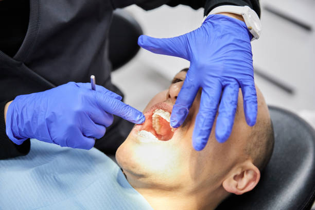 Best Broken or Cracked Tooth Emergency Dentist in South Cleveland, TN